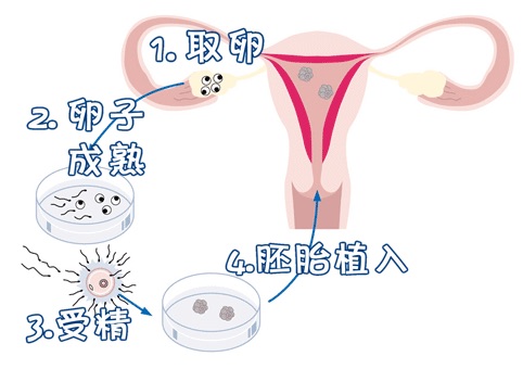中医妇科